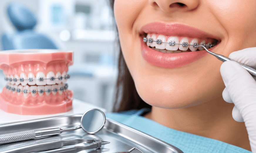 Orthodontics-treatment